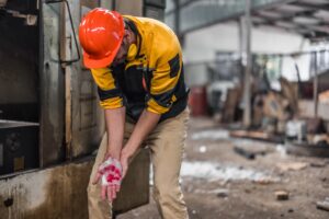 A warehouse worker holds his bandaged hand after being injured in a workplace accident.