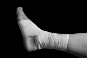 Bandaged sprained ankle. 