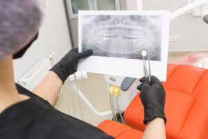 A dentist is examining a patients xray