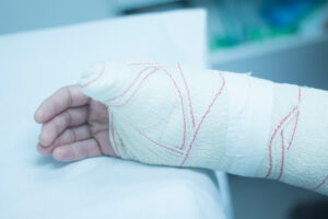 Injured hand in bandage.