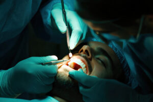 A dentist is removing a tooth