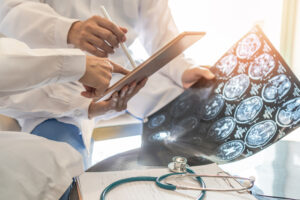 Doctors looking at a stroke patients brain scan which shows a blood clot.