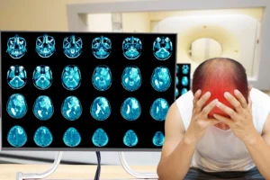 A man sits with his head in his hands in front of a monitor displaying a brain scan